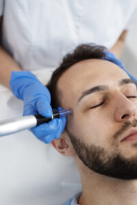 preparing utensils microneedling procedure